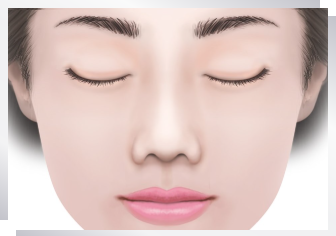 小鼻が垂れ下がっているタイプ