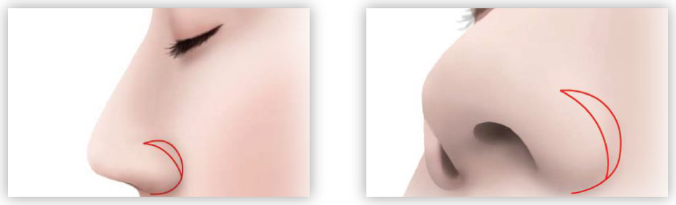 切開線のデザインを決めます