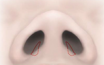 切開線のデザインを決めます