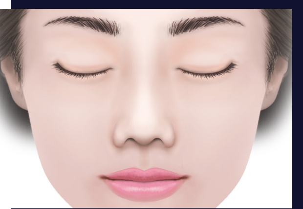 小鼻が垂れ下がっているとは・・・