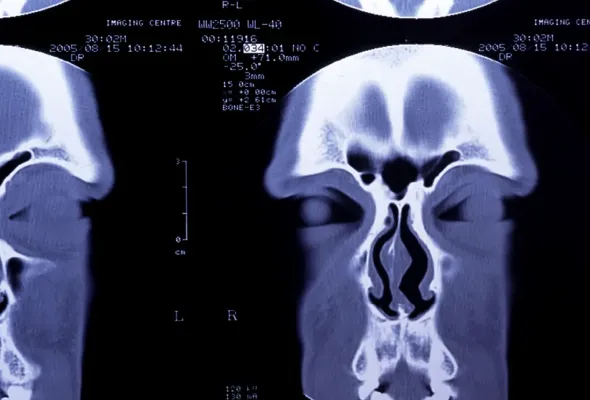 豊富な他院修正の実績